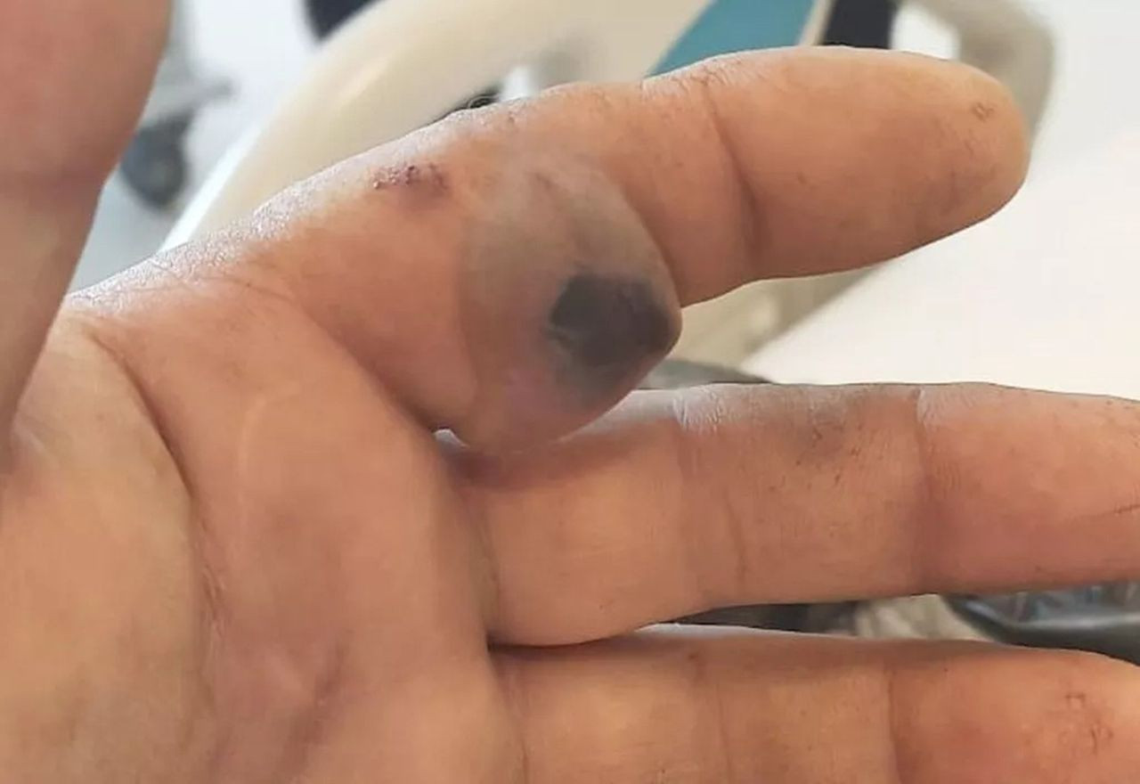 Bursa'da zehirli engerek yılanı paniği! - Resim: 4