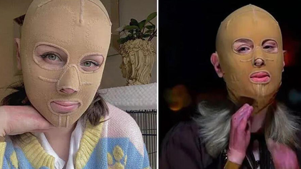 2.5 yıl sonra maskesini çıkardı, acılarını paylaştı