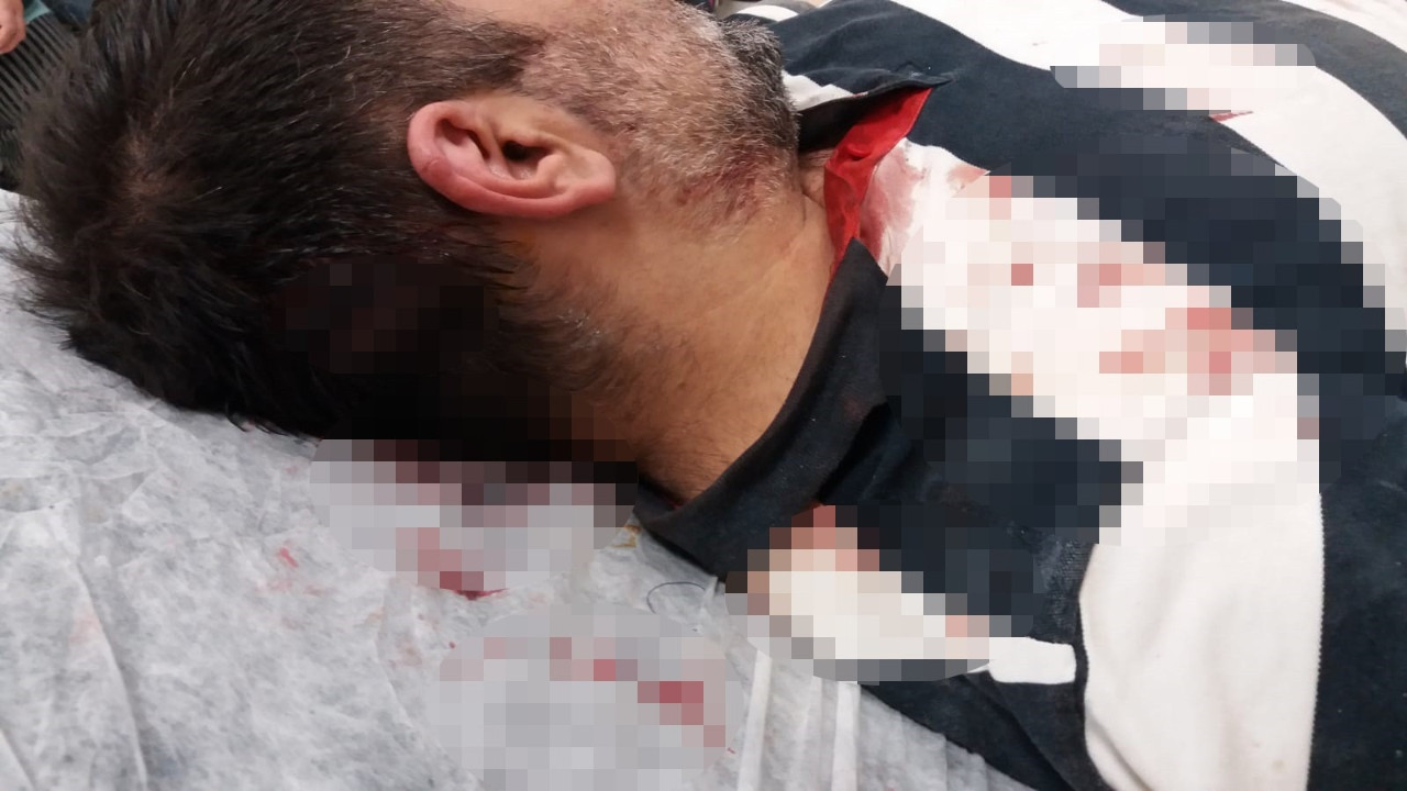 Kaçak inşaatı görüntüleyen gazeteciye kürekli saldırı