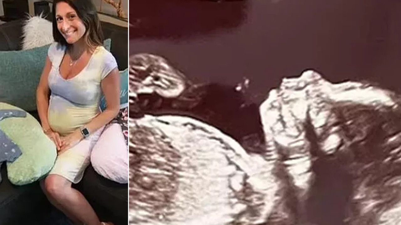 70 milyonda bir görülüyor! Ultrasona giren hamile kadın hayatının şokunu yaşadı