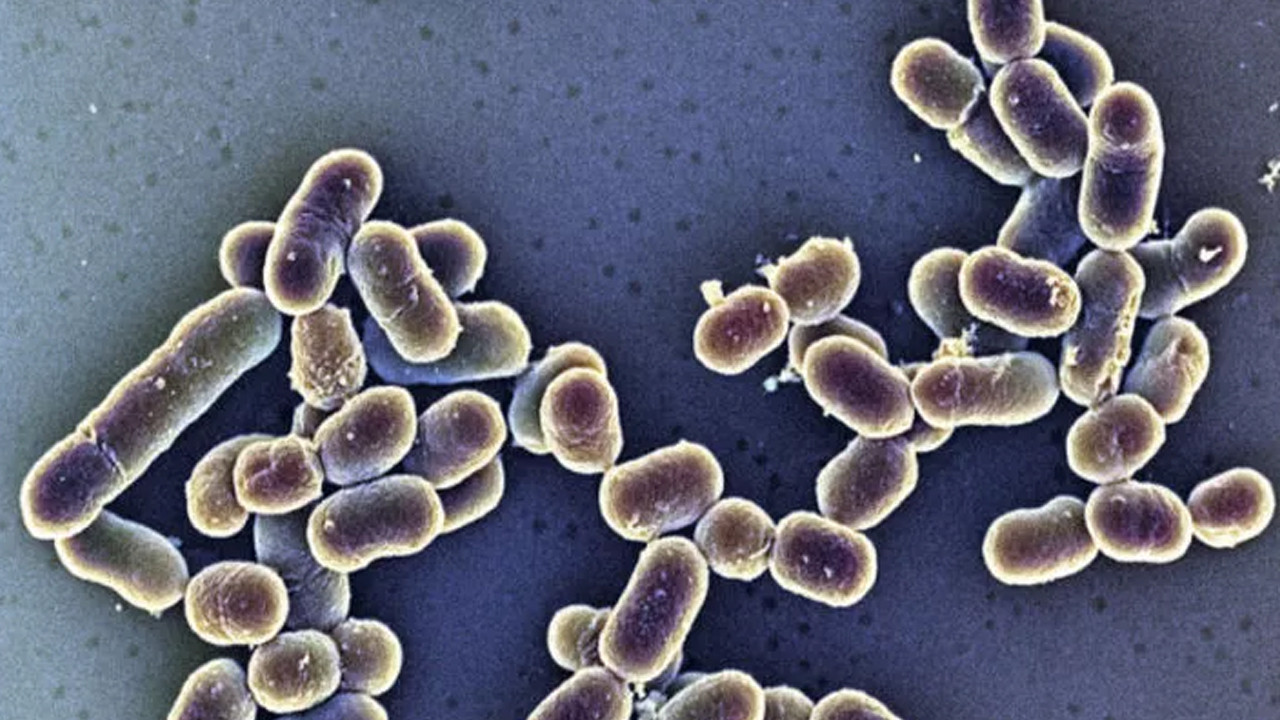 Amerika'da 10 farklı eyalette korkutan Listeria salgını: Bakın neyden bulaşmış!