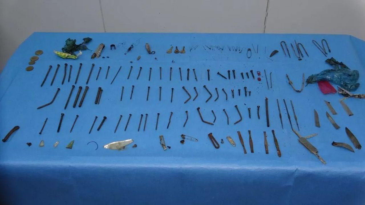 Karın ağrısıyla gitmişti... Doktorlar ameliyatta neye uğradığını şaşırdı - Resim: 3