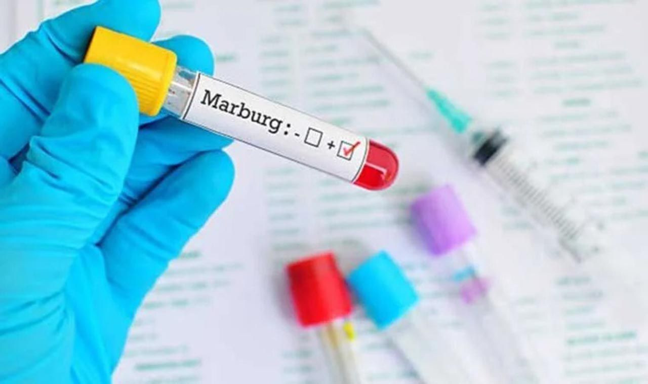 Aşısı ve tedavisi yok! Marburg hummasının semptomları belli oldu - Resim: 4
