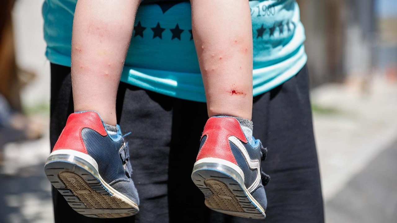 İstanbul'da ''Aedes'' tehdidi! Vatandaşın kabusu oldular