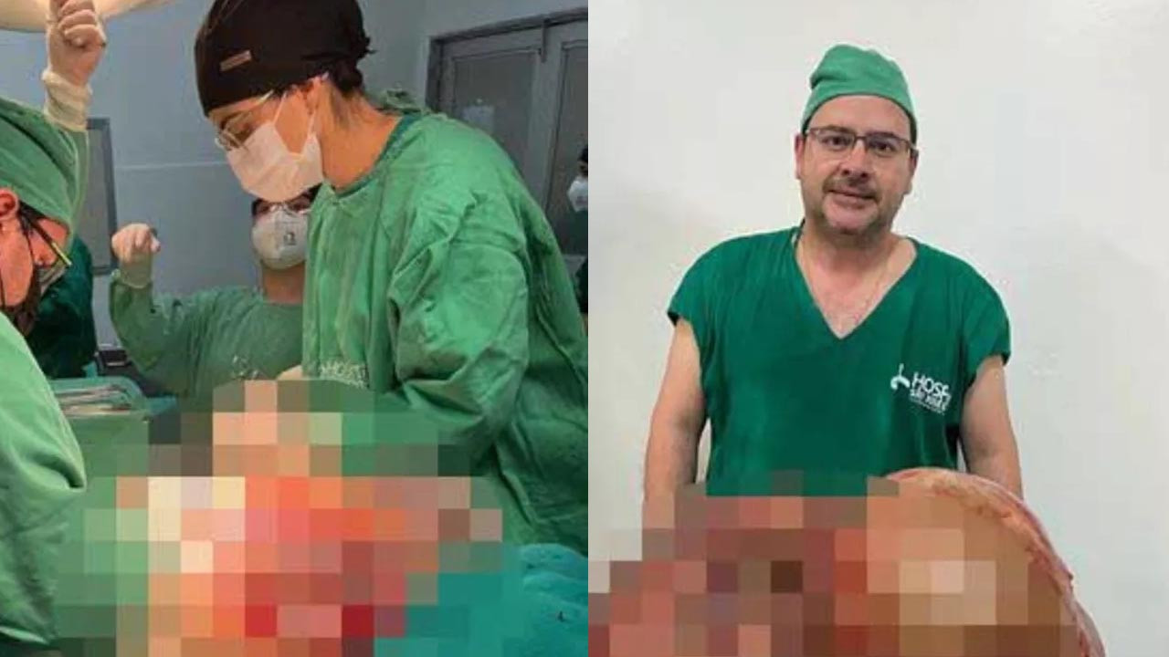 Tüm hastane seferber oldu: 45 yaşındaki kadının karnından 100 kiloluk tümör çıkarıldı