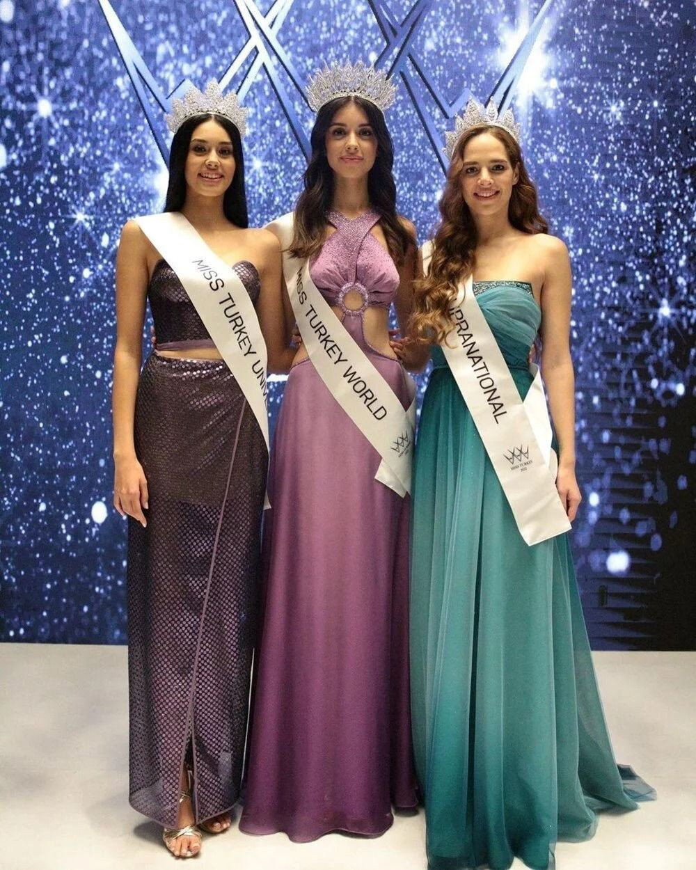 Miss Turkey 2022 birincisi Nursena Say'dan estetik açıklaması - Resim: 3