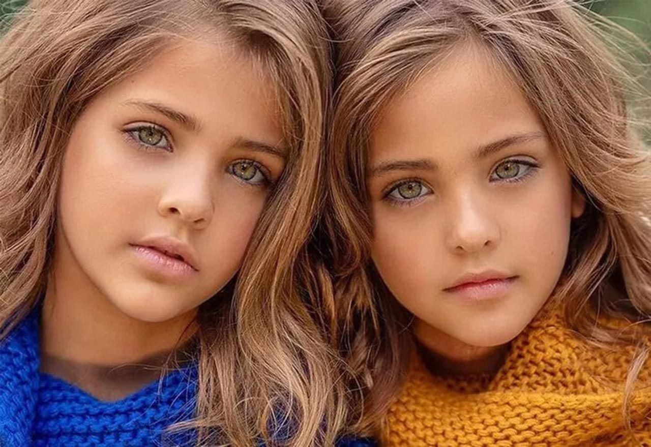 Dünyanın en güzel ikiz çocuklarıydı: Son halleri ile şaşırttı - Resim: 1