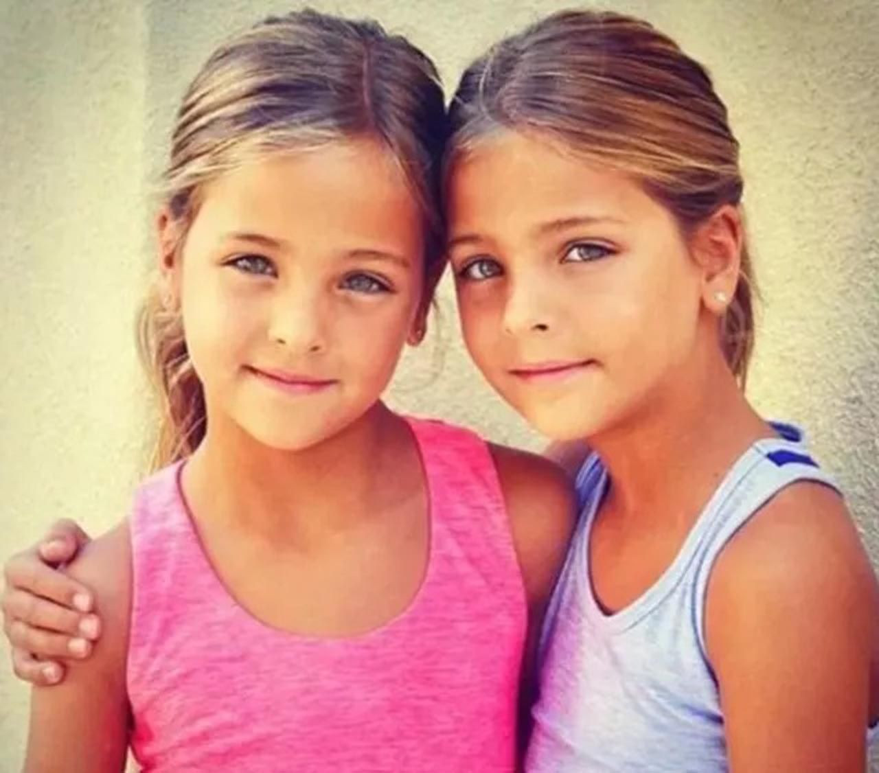 Dünyanın en güzel ikiz çocuklarıydı: Son halleri ile şaşırttı - Resim: 3