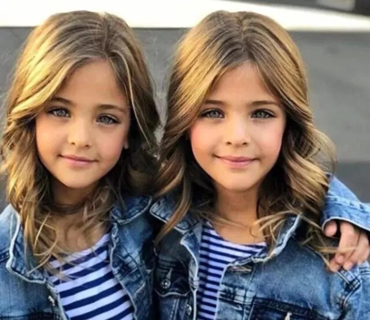 Dünyanın en güzel ikiz çocuklarıydı: Son halleri ile şaşırttı - Resim: 4