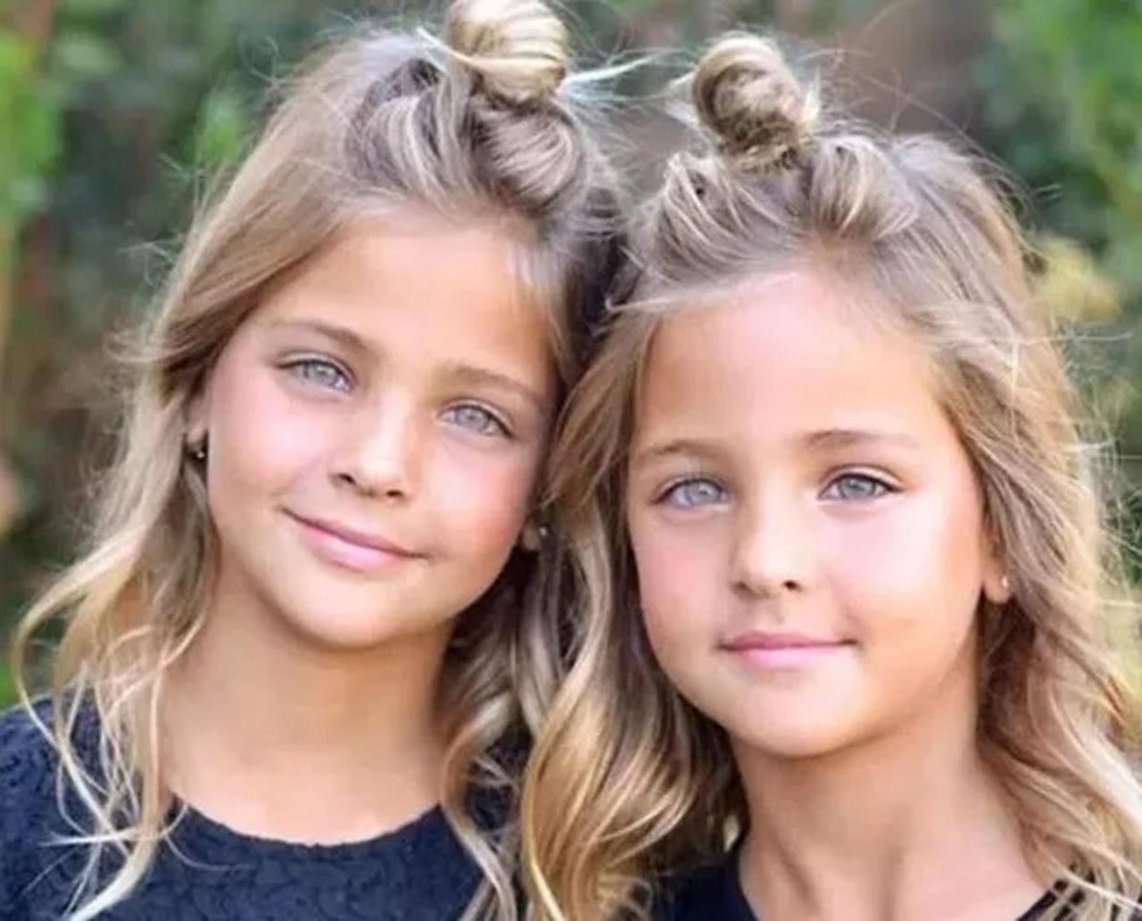 Dünyanın en güzel ikiz çocuklarıydı: Son halleri ile şaşırttı - Resim: 2