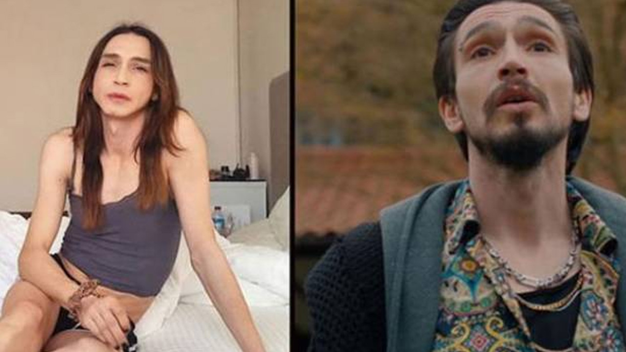 Cinsiyet değiştiren Çukur'un Timsah'ı yaptırdığı estetikle gündeme geldi
