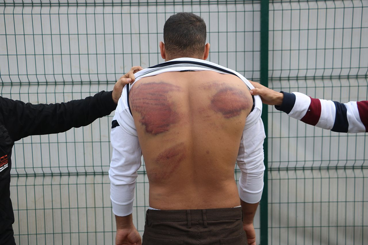 Kaçak sığınmacılara ölümcül işkence! Görüntüler korkunç - Resim: 3