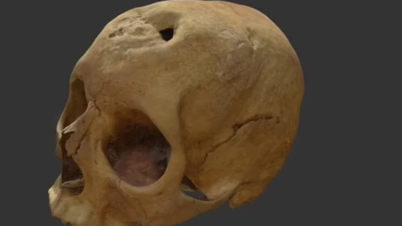 Cinsel hastalık kafatasını deldi: 500 yıl önce ölen kadın böyle canlandırıldı