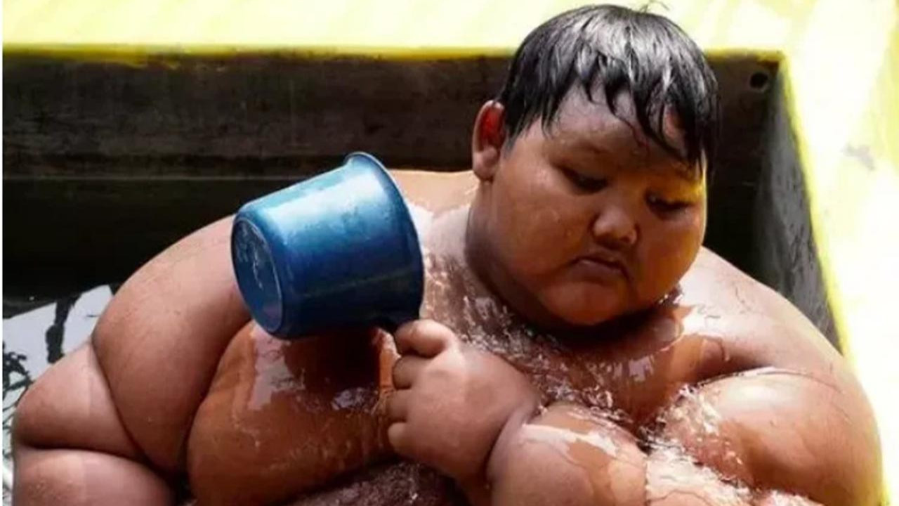 Dünyanın en şişman çocuğu obeziteyi yendi! Son hali inanılmaz
