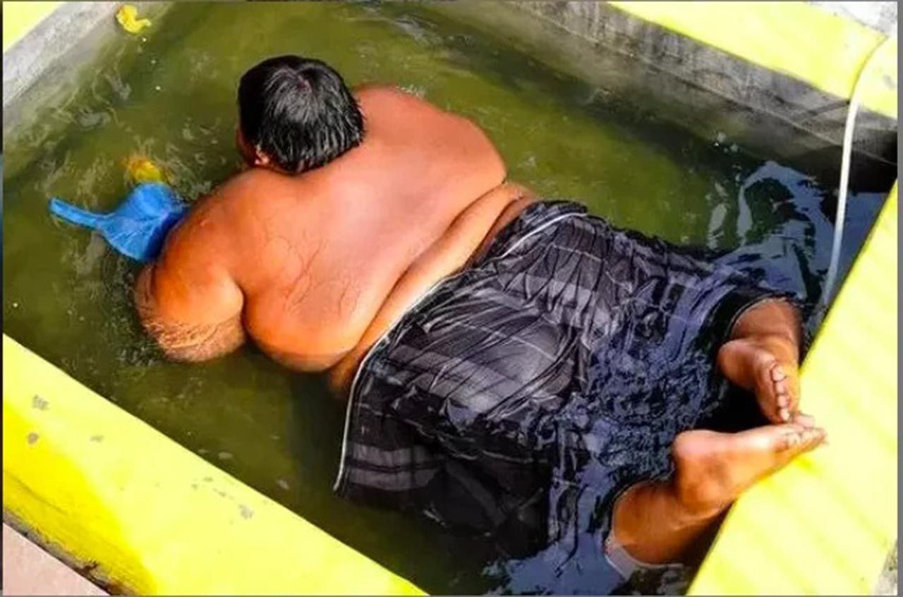 Dünyanın en şişman çocuğu obeziteyi yendi! Son hali inanılmaz - Resim: 1