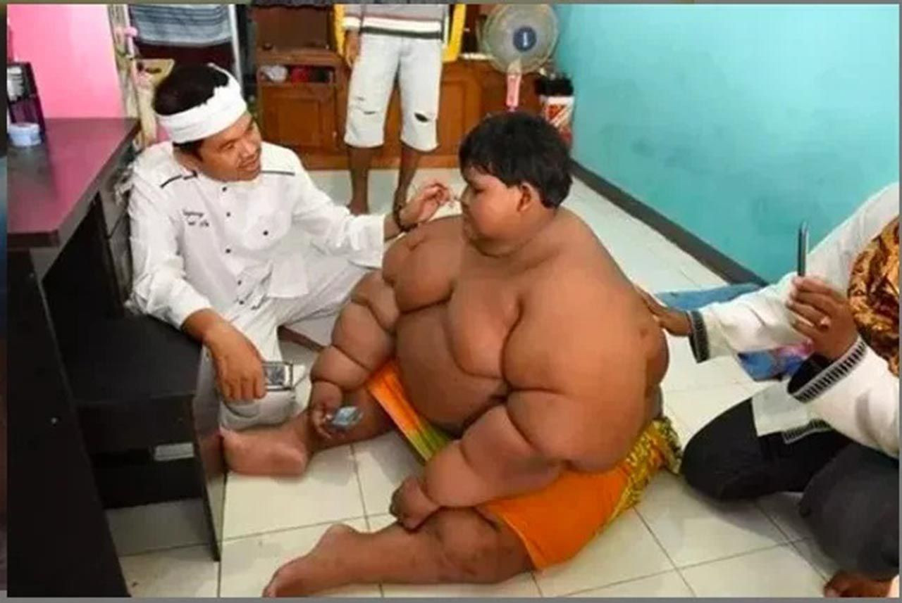 Dünyanın en şişman çocuğu obeziteyi yendi! Son hali inanılmaz - Resim: 4