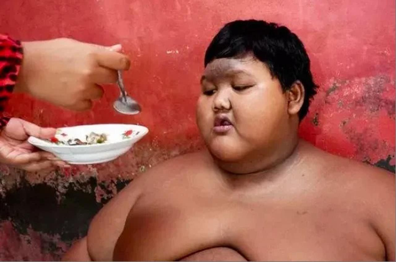 Dünyanın en şişman çocuğu obeziteyi yendi! Son hali inanılmaz - Resim: 2