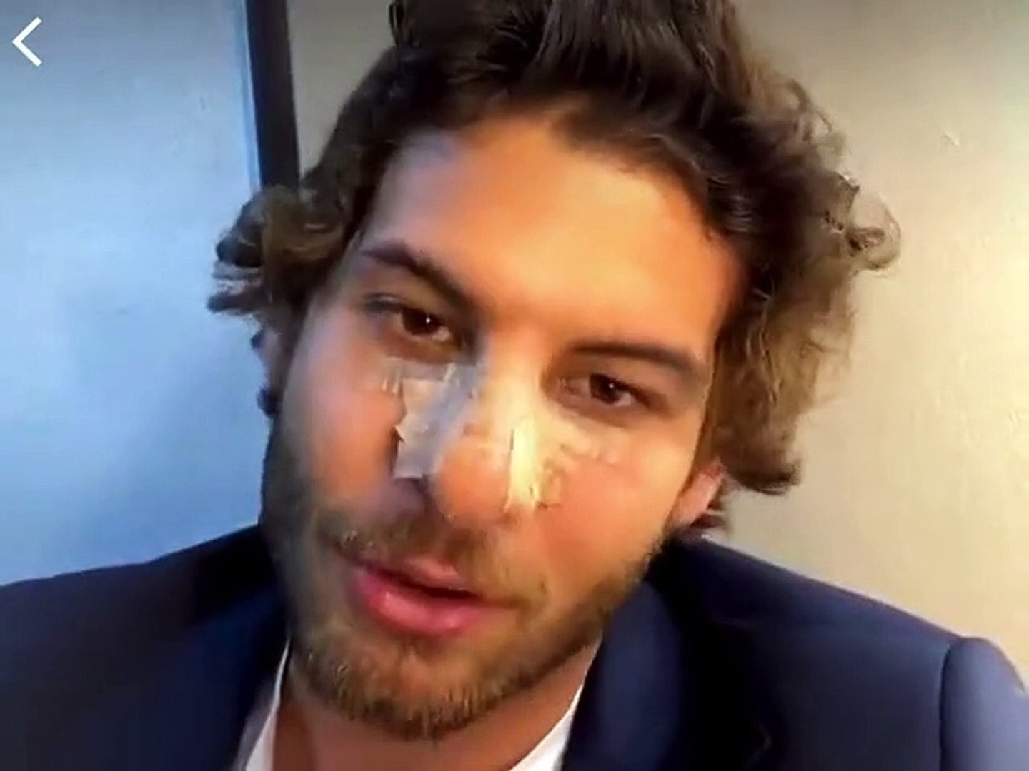 Fox TV'nin dizisindeki kavga sahnesinde oyuncunun burnu kırıldı