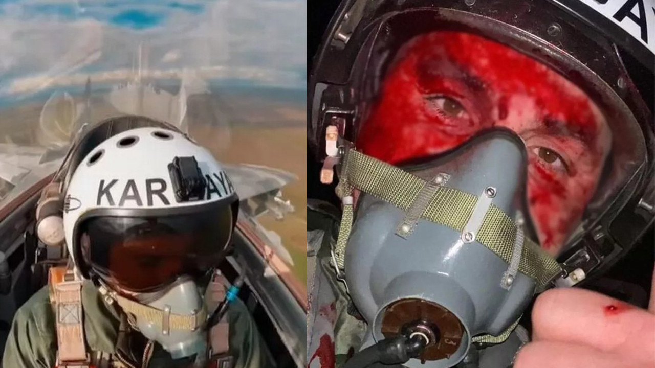 Savaş uçağı pilotu kokpitte kanlar içinde kaldı!