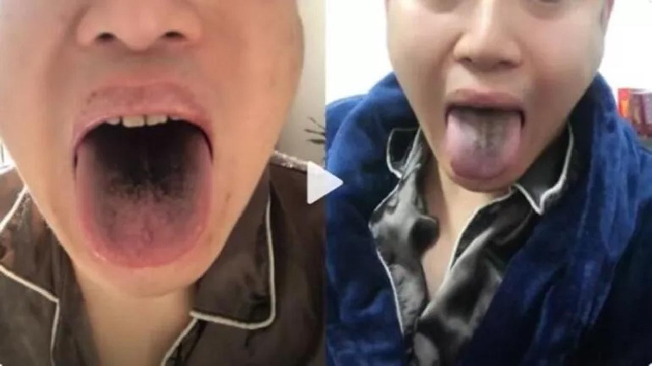 Covid-19 Çin'de mutasyona uğradı iddiası! Semptomlar değişti