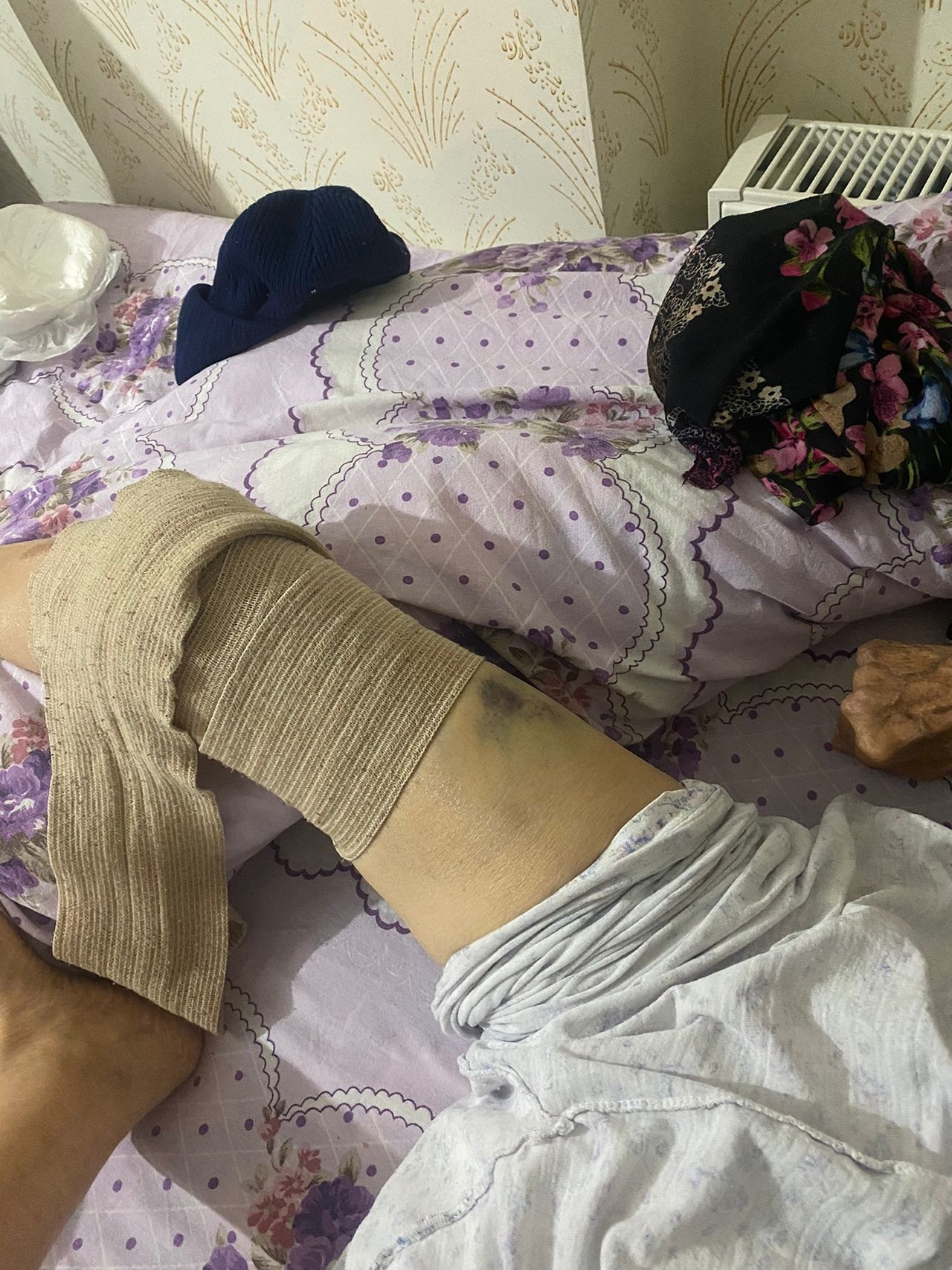 91 yaşındaki yaşlı kadına kan donduran bakıcı işkencesi - Resim: 1
