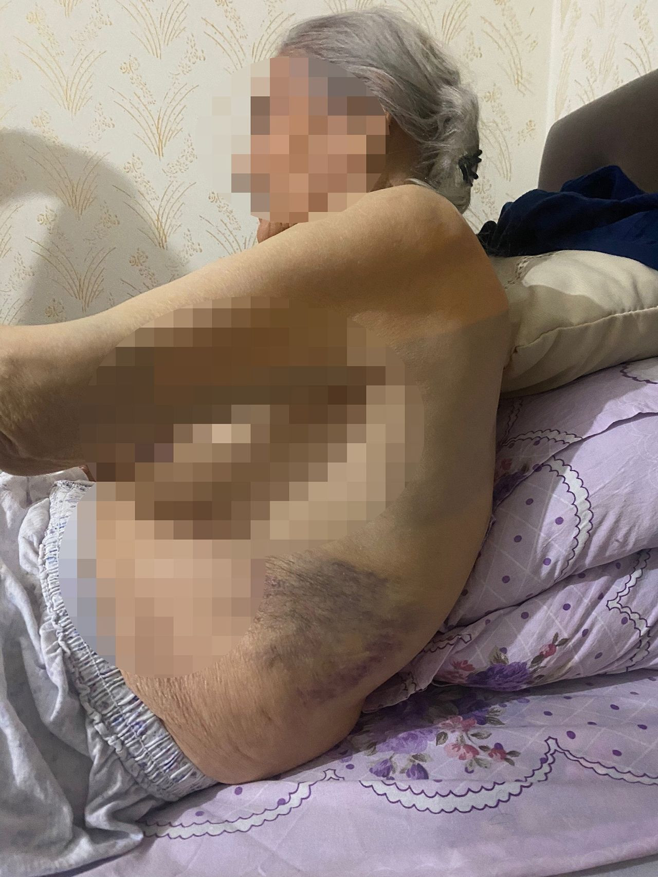 91 yaşındaki yaşlı kadına kan donduran bakıcı işkencesi - Resim: 2
