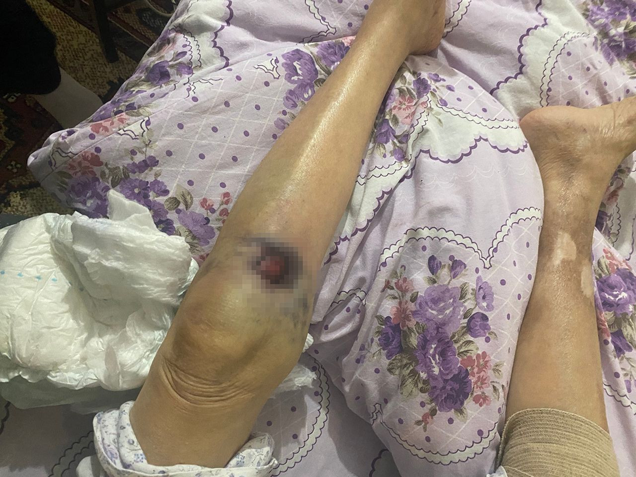 91 yaşındaki yaşlı kadına kan donduran bakıcı işkencesi - Resim: 4