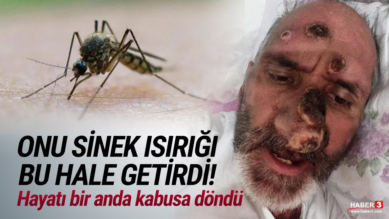 Sinek ısırığı hayatını kabusa çevirdi