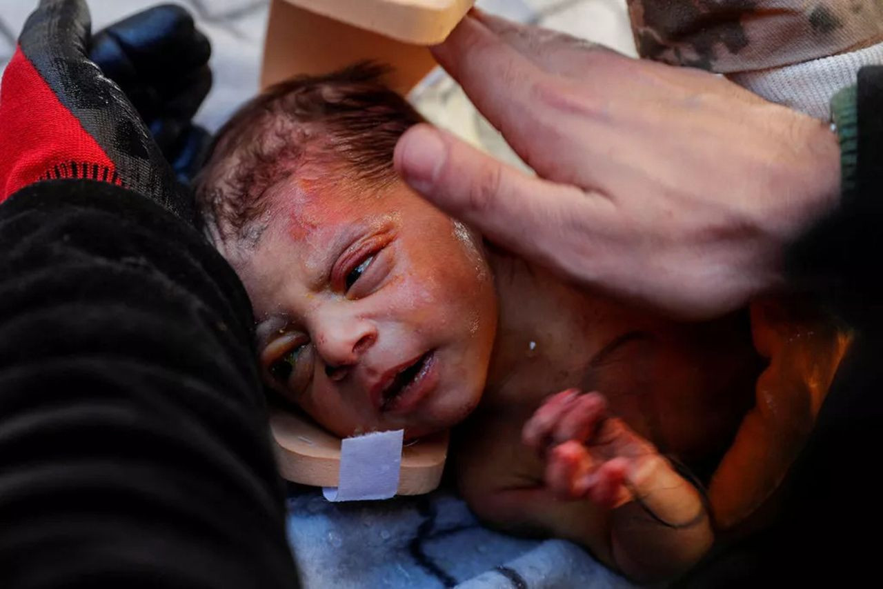 Minik bebek enkazdan elinde annesinin saçıyla çıkarıldı - Resim: 3