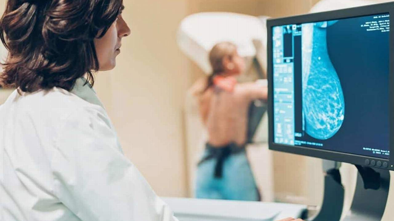 Mamografi Nedir? Kimlere Uygulanır?