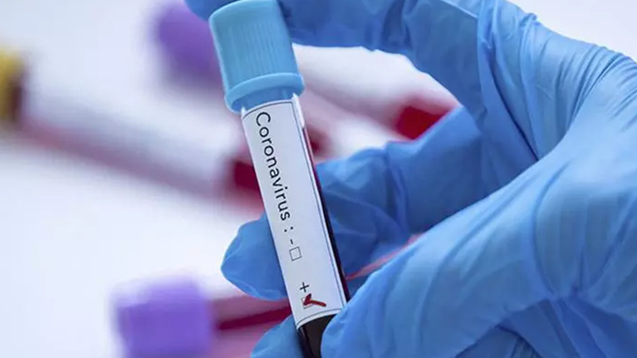 DSÖ duyurdu: Koronavirüs bitti mi?