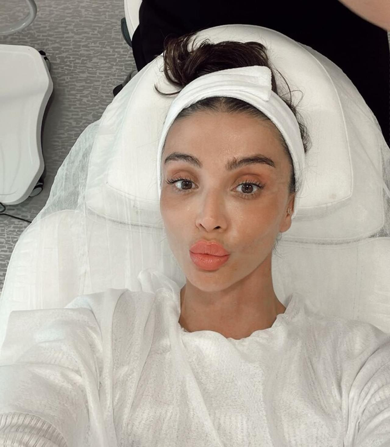 Özge Ulusoy estetiğin dozunu fazla kaçırdı! - Resim: 3
