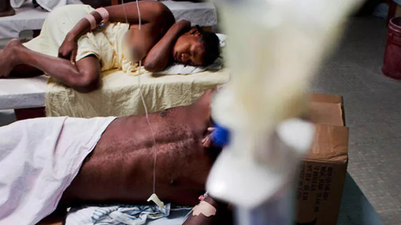 Kolera salgını büyüyor! Can kaybı 32'ye yükseldi