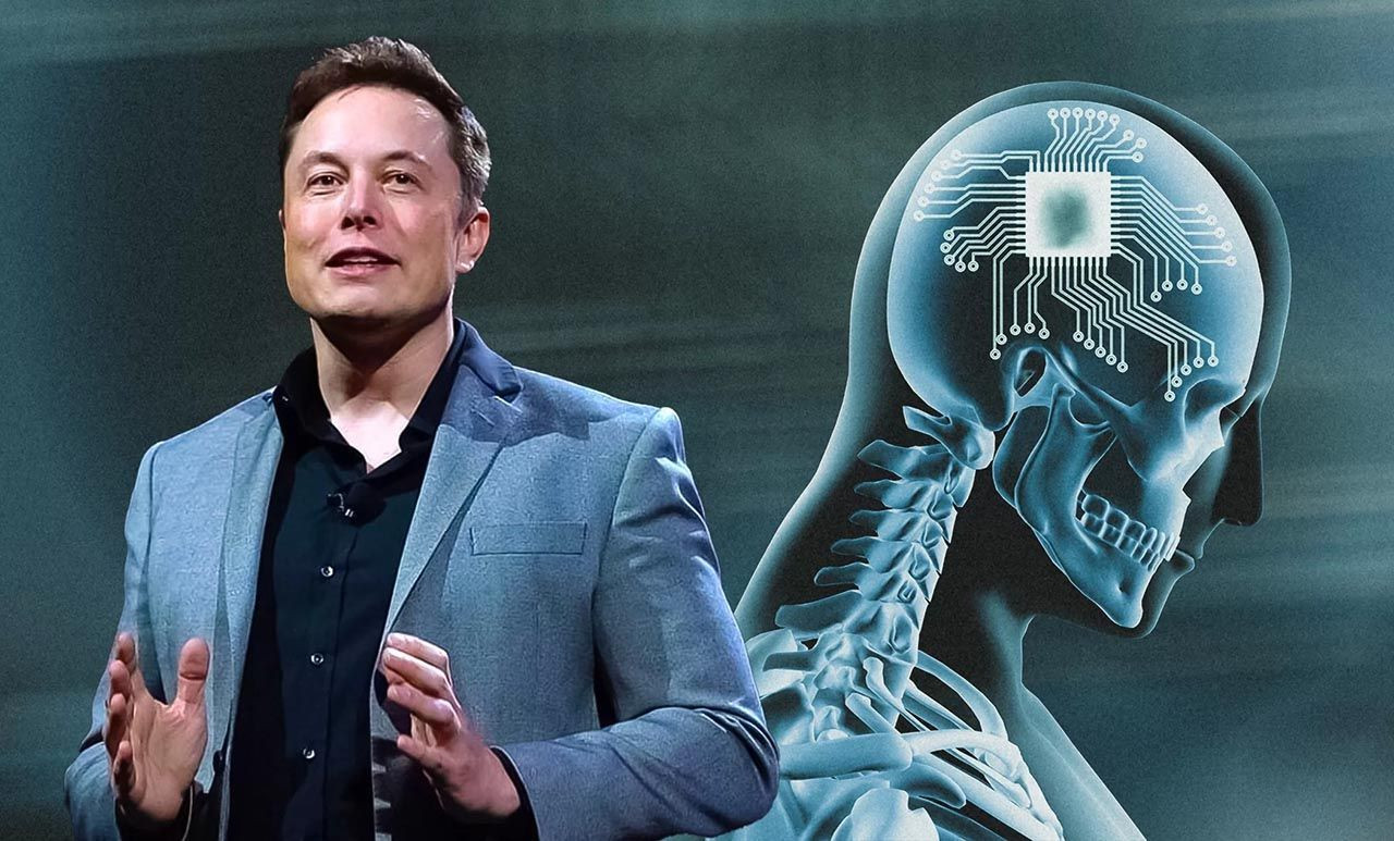 Elon Musk'ın çılgın projesi Neuralink, insan çalışması için onay aldı - Resim: 1