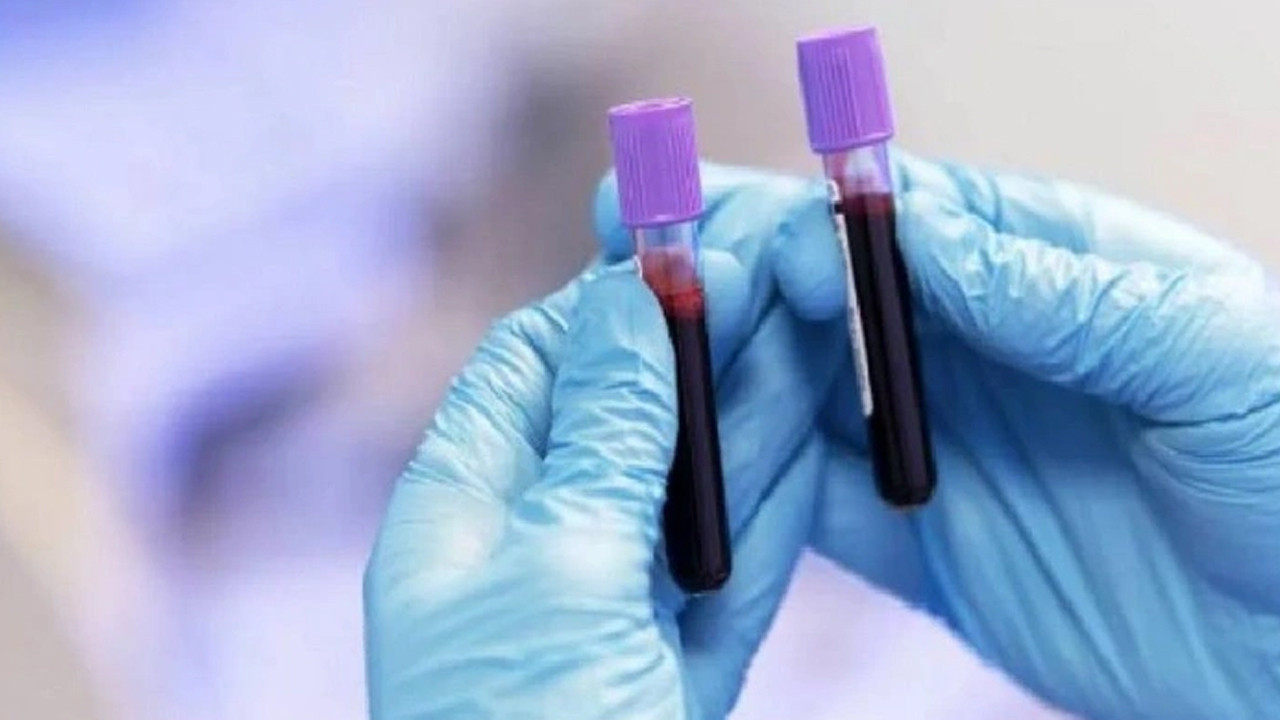 Bilim insanları açıkladı: Bu kan grubuna sahip olanlar dikkat