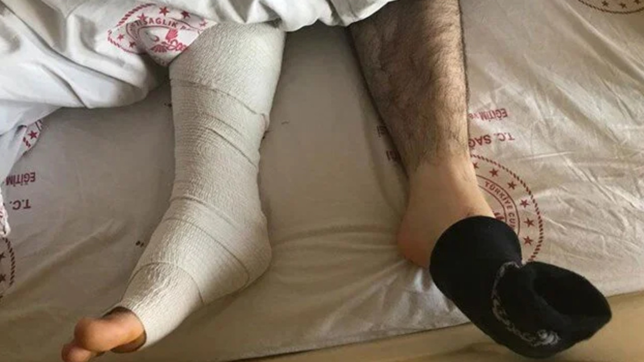 Devlet hastanesinde akılalmaz hata! Yanlış ayağı ameliyat ettiler