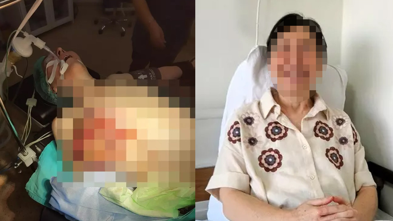 Doktora gitmeyerek aylarca karpuz büyüklüğündeki tümörle yaşadı