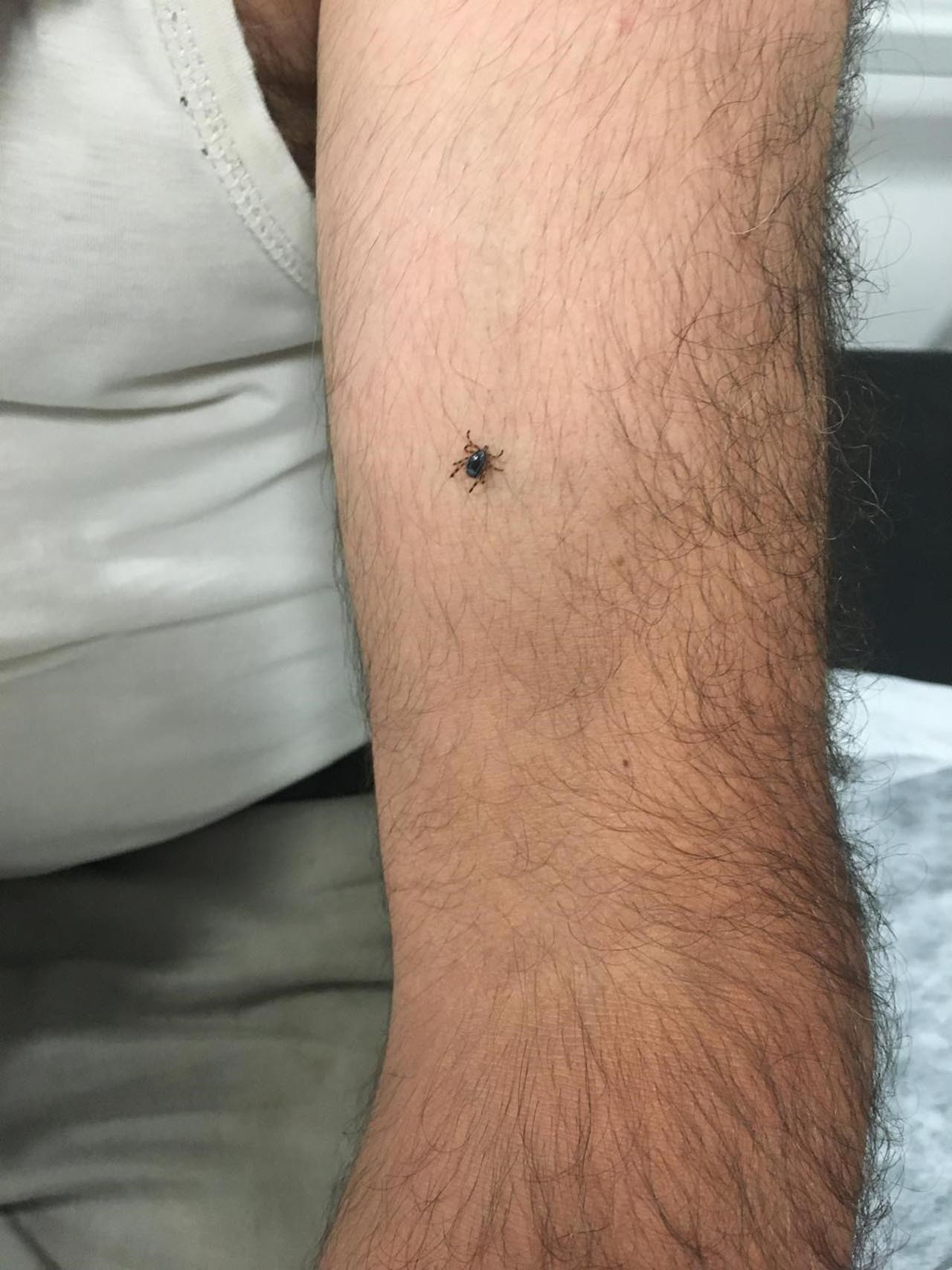 Elazığ'da Kırım Kongo Kanamalı Ateşi (KKKA) şüphesiyle tedavi gören 69 yaşındaki H.K., hayatını kaybetti.