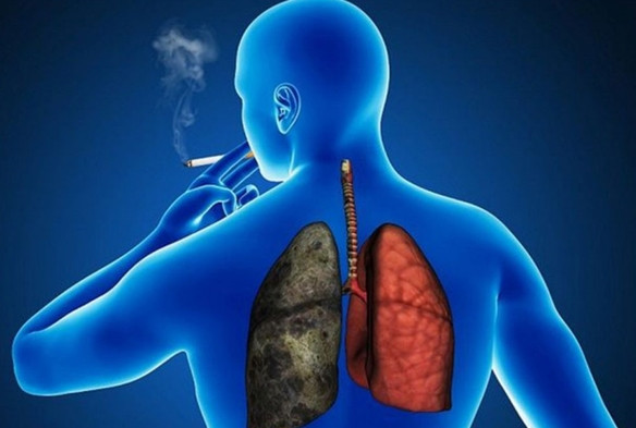 koah nedir nasil tedavi edilir